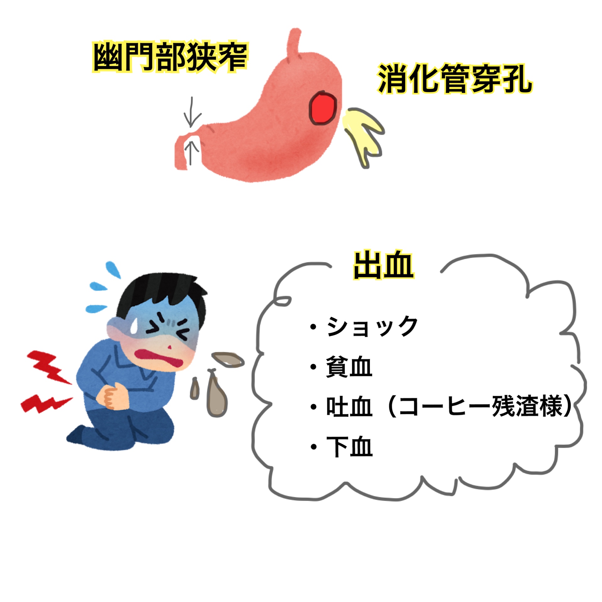出血性胃潰瘍看護: 胃癌 ガイドライン : 胃瘻(PEG)のトラブル対処 – KRCTV